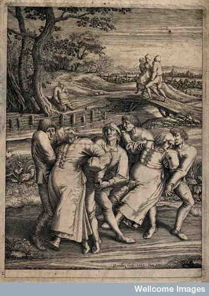 Three epileptic women each supported by two men or dancing plague, choreomania, St John's Dance (historically St. Vitus' Dance).